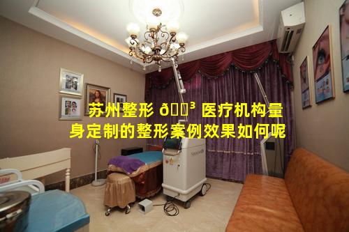 苏州整形 🐳 医疗机构量身定制的整形案例效果如何呢